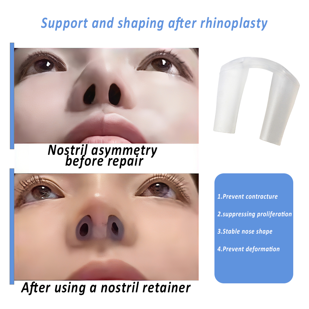 Nostril Retainer For Post-Rhin - Anti Snore Contour Pillow review and price
